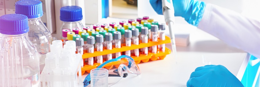 亞硝酸根檢測(cè)