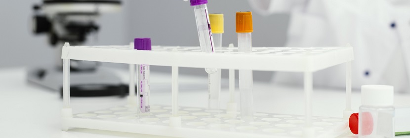 乙酸異戊酯檢測