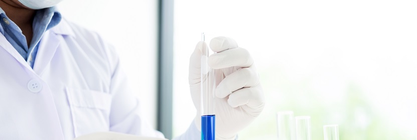 耐熱多楔帶用浸膠聚酯線繩檢測